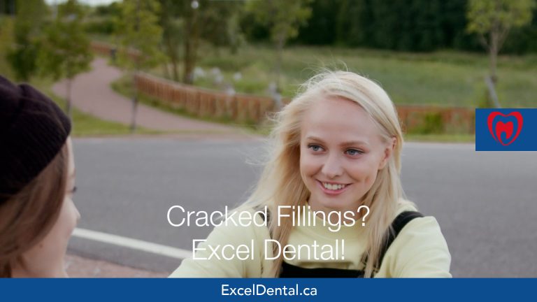 Cracked Fillings – Part 2