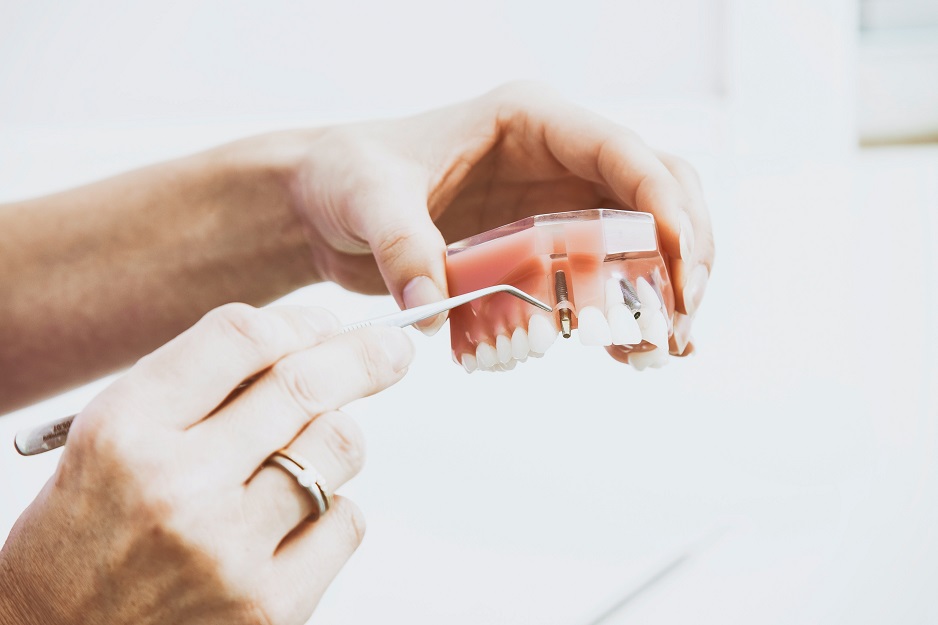 dentist-showing-dental-implant-model