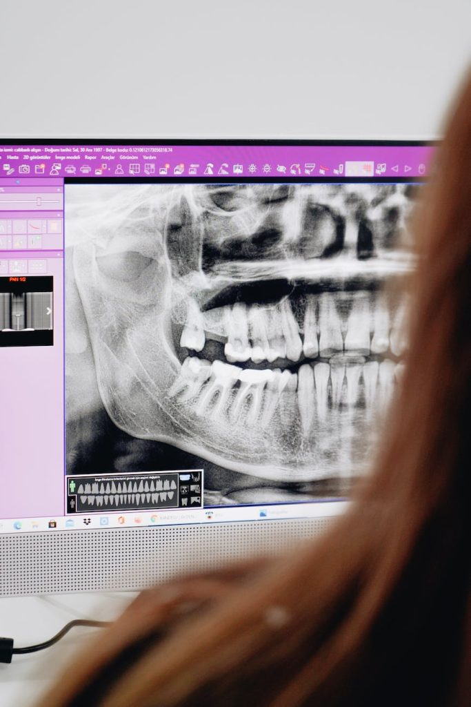 Panoramic dental x-ray displayed on a computer monitor with a person viewing the screen