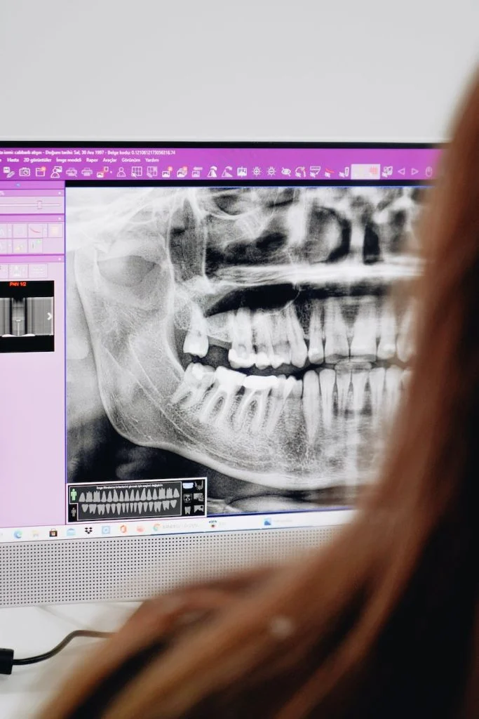 Panoramic dental x-ray displayed on a computer monitor with a person viewing the screen