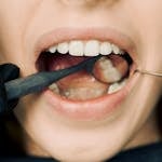 Close-up of a dental exam with a mirror and probe inside a patient's mouth.