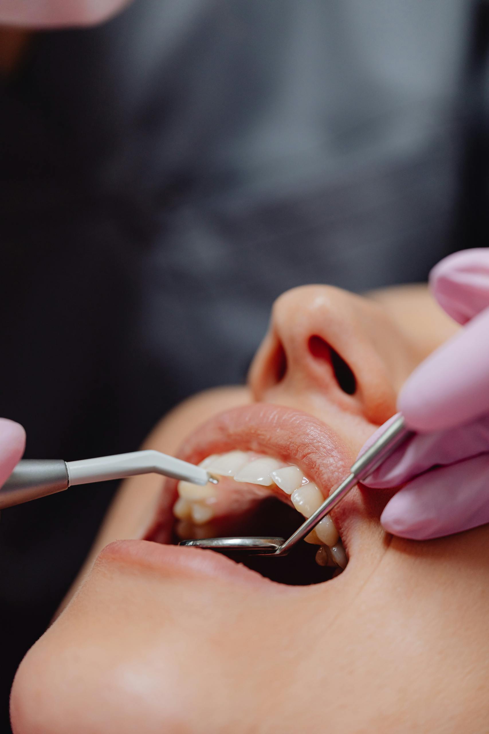 Close-up of a patient’s mouth during a dental exam with a mirror, dental tool, and gloved hands.