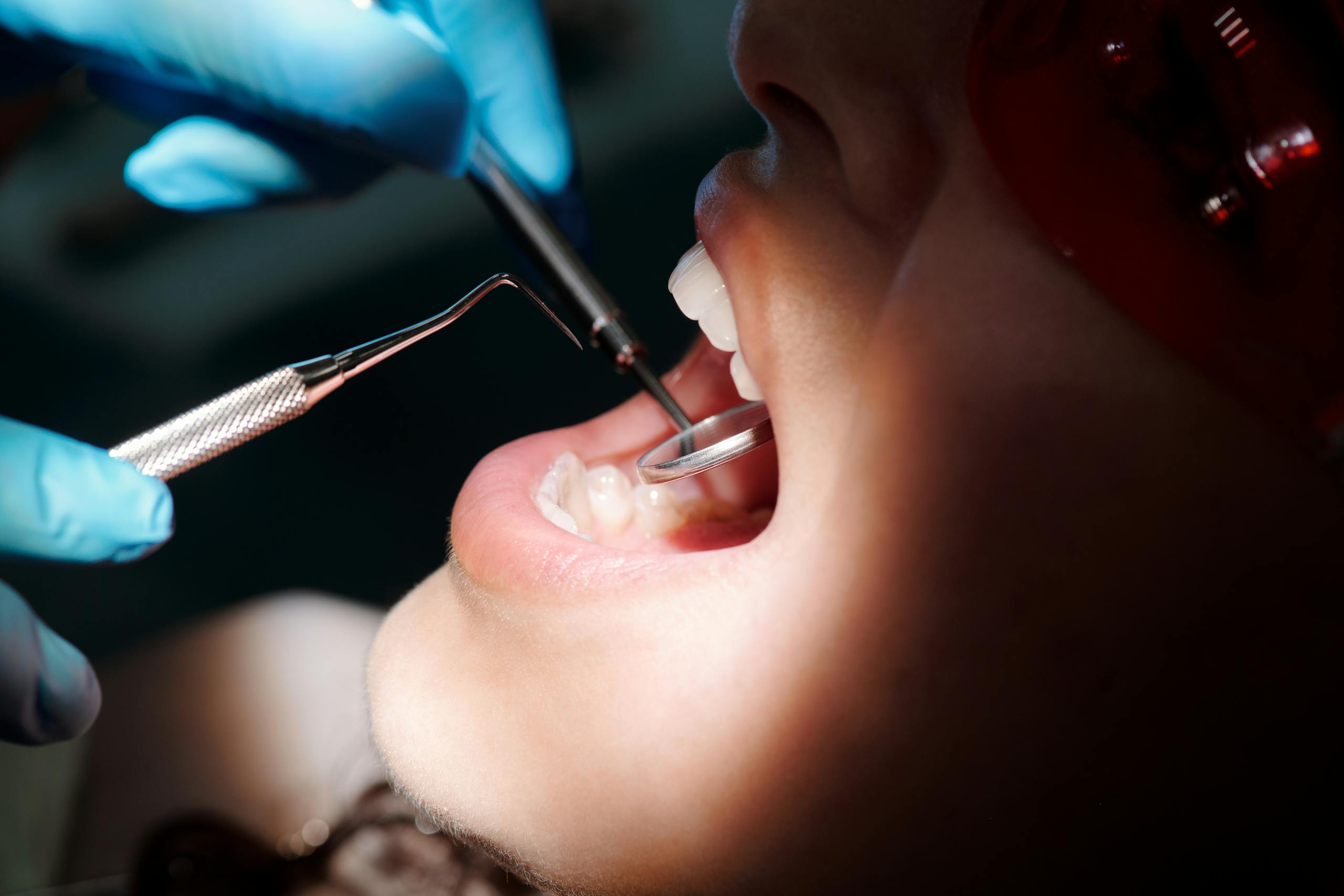Close-up of a dental exam with a mirror and explorer inspecting a patient's teeth under bright light.