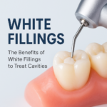 Graphic showing a white filling being placed in a molar with a dental tool