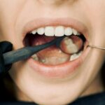 Close-up of a dental exam with a mirror and probe inside a patient's mouth.